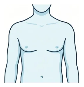 Grade 1 gynecomastia: slight enlargement around the nipple